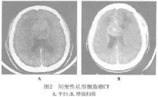 團團死因出爐